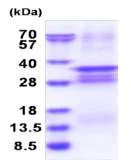 SDS-PAGE - Recombinant Human OSR2 protein (denatured) (His tag N-Terminus) (AB183242)