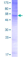 SDS-PAGE - Recombinant Human OSTA protein (AB165873)