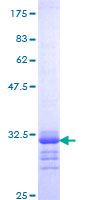 SDS-PAGE - Recombinant Human Osteocalcin protein (AB152232), expandable thumbnail