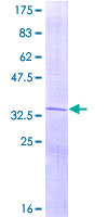 SDS-PAGE - Recombinant Human Osteocalcin protein (AB152231)