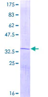 SDS-PAGE - Recombinant Human Osteocalcin protein (GST tag N-Terminus) (AB152231)
