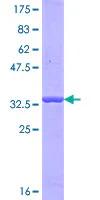 SDS-PAGE - Recombinant Human Otoferlin protein (GST tag N-Terminus) (AB152978)