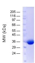 SDS-PAGE - Recombinant human OTUB1 protein (AB157086)