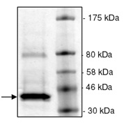 Recombinant human OTUD6B protein