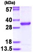 SDS-PAGE - Recombinant Human OVCA2 protein (AB130016)