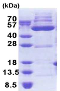SDS-PAGE - Recombinant Human OXSM protein (His tag N-Terminus) (AB171708)
