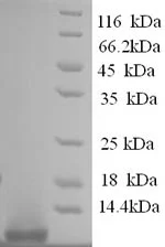 SDS-PAGE - Recombinant Human Oxyntomodulin (His tag N-Terminus) (AB240833)