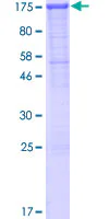 SDS-PAGE - Recombinant Human P cadherin protein (GST tag N-Terminus) (AB158078)