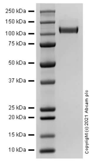 SDS-PAGE - Recombinant Human P-Selectin (CD62P) protein (AB283446)