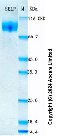 SDS-PAGE - Recombinant Human P-Selectin Protein Standard (His tag) (AB322090)
