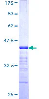 SDS-PAGE - Recombinant Human p0071 protein (GST tag N-Terminus) (AB160058)