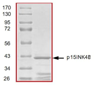 SDS-PAGE - Recombinant Human p15 INK4b protein (Tagged) (AB268830)