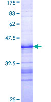 Recombinant Human p150 CAF1/CAF protein