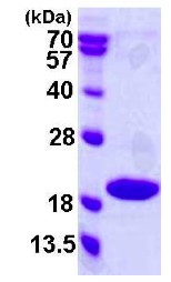 SDS-PAGE - Recombinant Human p18 INK4c/CDKN2C protein (AB119460), expandable thumbnail