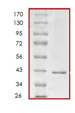 SDS-PAGE - Recombinant Human p18 INK4c/CDKN2C protein (AB85605), expandable thumbnail