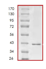 SDS-PAGE - Recombinant Human p18 INK4c/CDKN2C protein (AB85605)