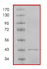 SDS-PAGE - Recombinant Human p19 INK4d protein (AB85658)