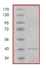 SDS-PAGE - Recombinant Human p19 INK4d protein (AB85658)