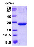 SDS-PAGE - Recombinant Human p21-ARC/ARPC3 protein (AB140715), expandable thumbnail
