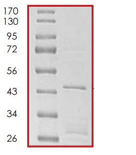 SDS-PAGE - Recombinant Human p21 protein (AB56278)
