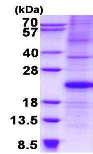 SDS-PAGE - Recombinant Human p21 protein (denatured) (AB134524), expandable thumbnail