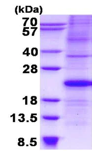 SDS-PAGE - Recombinant Human p21 protein (denatured) (His tag N-Terminus) (AB134524)