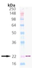 Western blot - Recombinant Human p23 protein (AB113183)