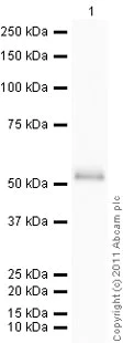 Western blot - Recombinant Human p27 KIP 1 protein (Tagged) (AB56279)