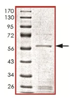 SDS-PAGE - Recombinant Human p35 protein (AB119724)