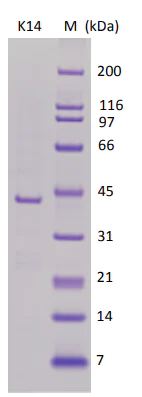 SDS-PAGE - Recombinant Human p38 alpha/MAPK14 protein (AB82188)