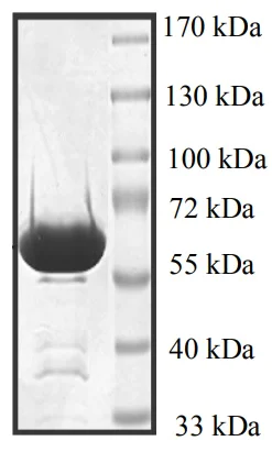 SDS-PAGE - Recombinant Human p38 alpha/MAPK14 protein (AB95445)