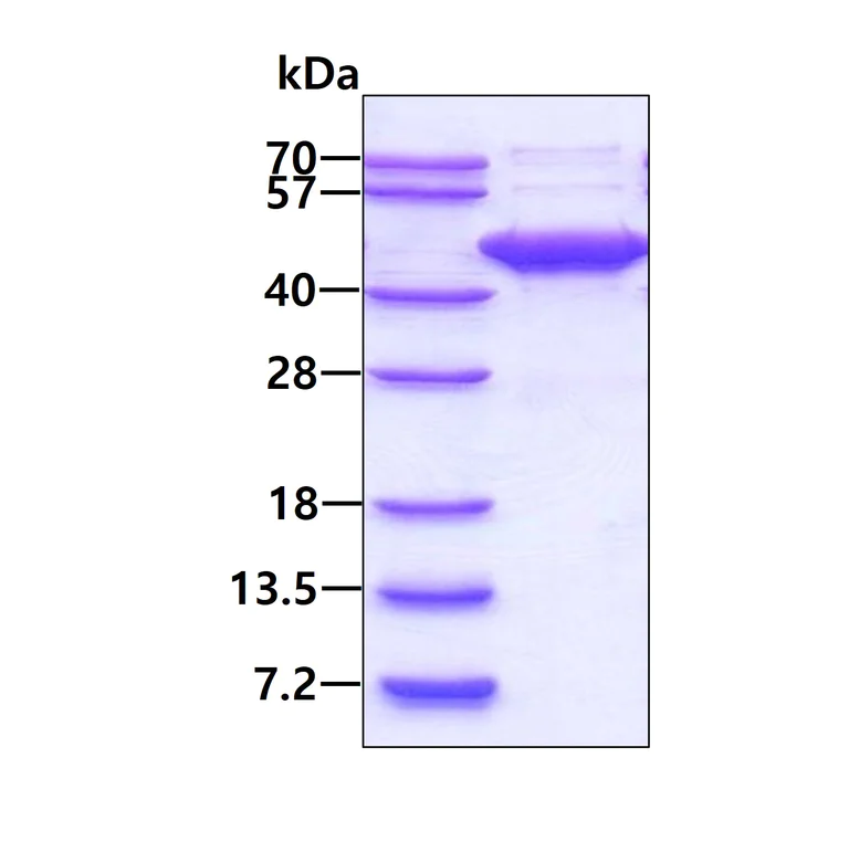 SDS-PAGE - Recombinant Human p38 beta/MAPK11 protein (His tag N-Terminus) (AB117219)