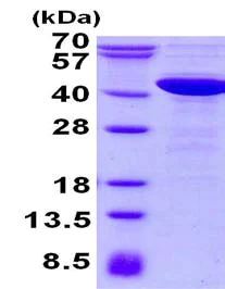 SDS-PAGE - Recombinant Human p40-phox protein (His tag N-Terminus) (AB134628)