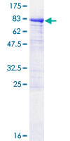 SDS-PAGE - Recombinant Human P4HA1 protein (AB114624), expandable thumbnail