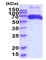 Recombinant human P4HB protein (His tag)