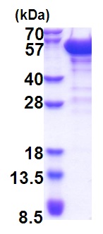 SDS-PAGE - Recombinant Human p50 dynamitin protein (His tag N-Terminus) (AB174453)