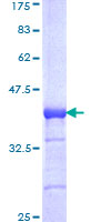 Recombinant Human p53 BP3 protein (Tagged)