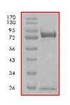 Recombinant Human p53 protein