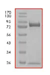 SDS-PAGE - Recombinant Human p53 protein (AB84768)
