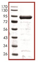 SDS-PAGE - Recombinant Human p73 beta protein (AB102553), expandable thumbnail