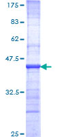 SDS-PAGE - Recombinant Human p95/NBS1 protein (AB158956), expandable thumbnail