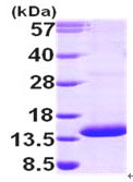 SDS-PAGE - Recombinant Human PAC-3 protein (His tag N-Terminus) (AB99521)