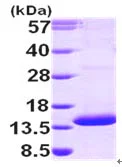 SDS-PAGE - Recombinant Human PAC-3 protein (His tag N-Terminus) (AB99521)