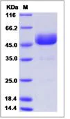 SDS-PAGE - Recombinant Human PACAP protein (Fc Chimera) (AB276678)