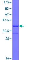 Recombinant Human PACAP receptor/ADCYAP1R1 protein