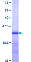 SDS-PAGE - Recombinant Human PACE4 protein (AB114961)