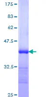 SDS-PAGE - Recombinant Human PACE4 protein (AB114961)