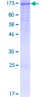 SDS-PAGE - Recombinant Human PACS2 protein (AB161579), expandable thumbnail