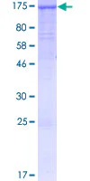 SDS-PAGE - Recombinant Human PACS2 protein (GST tag N-Terminus) (AB161579)