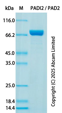 SDS-PAGE - Recombinant Human PADI2 / PAD2 Protein Standard (His) (AB323991)